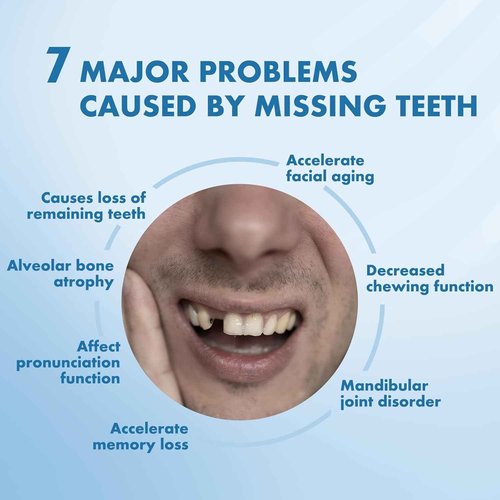 Partial Dentures - Custom Removable Personalized Tooth Replacement Set for Missing Teeth & Gap (1 Tooth)