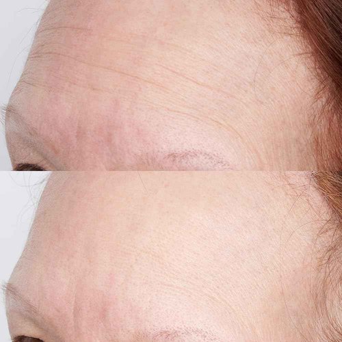Perricone MD High Potency Hyaluronic Intensive Hydrating Mask, 2 fl. oz.