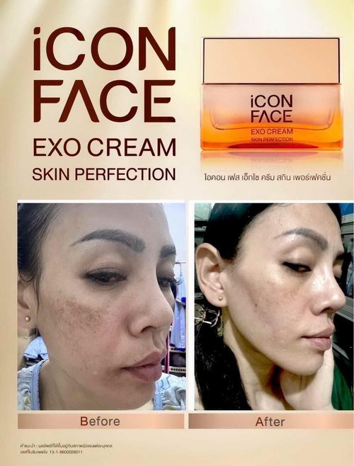 ICON FACE EXO CREAM SKIN PERFECTION WITH STEM CELLS AND SALMON OVUM EXTRACT, ANTI AGING CREAM, WRINKLE Reduce Wrinkle, Dark Circle, Dry Skins, Multi Nutrients, Vitamin B3, B5, C-50 ml