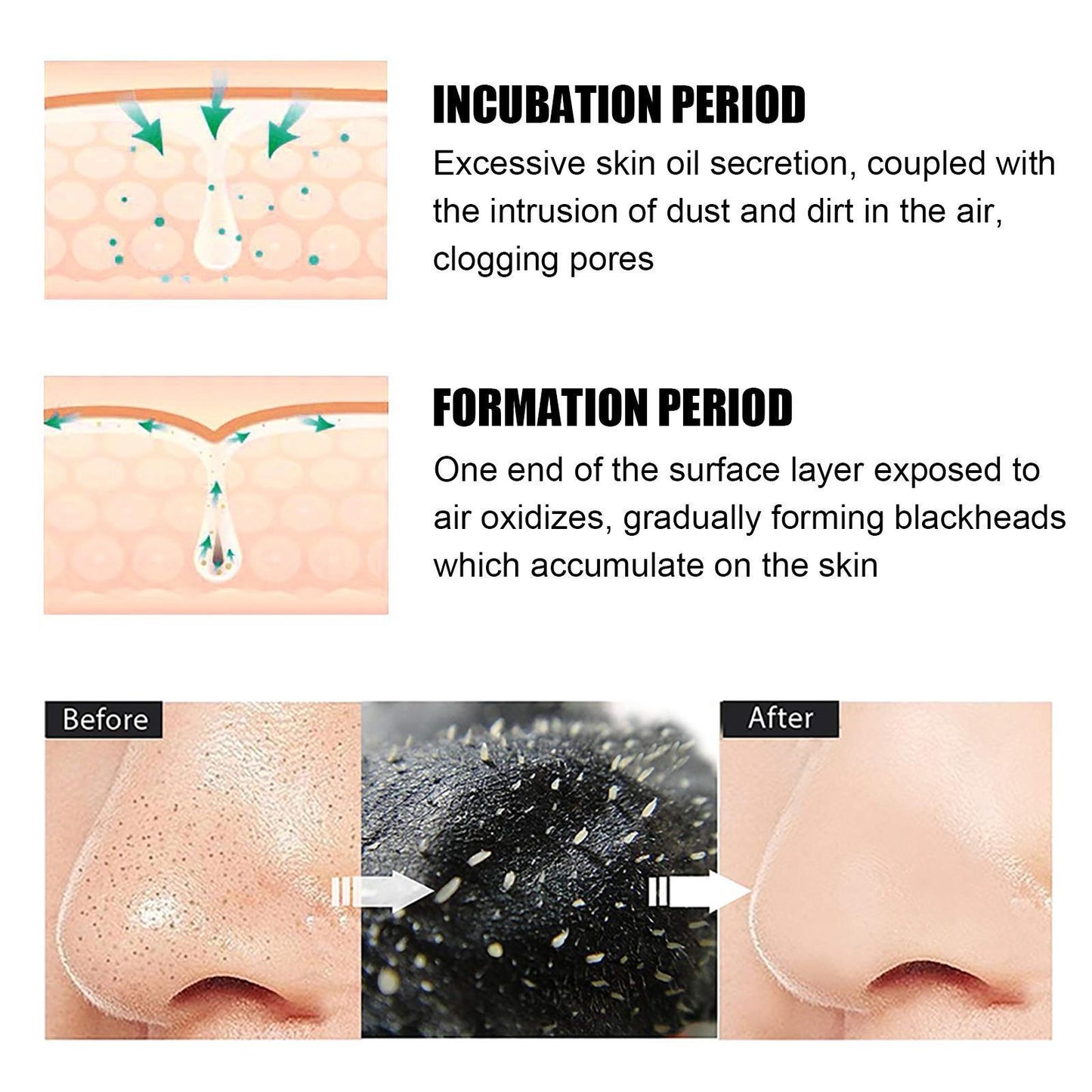 10 Pcs Blackhead Remover Nose Strips - Deep Pore Cleansing & Oil Control