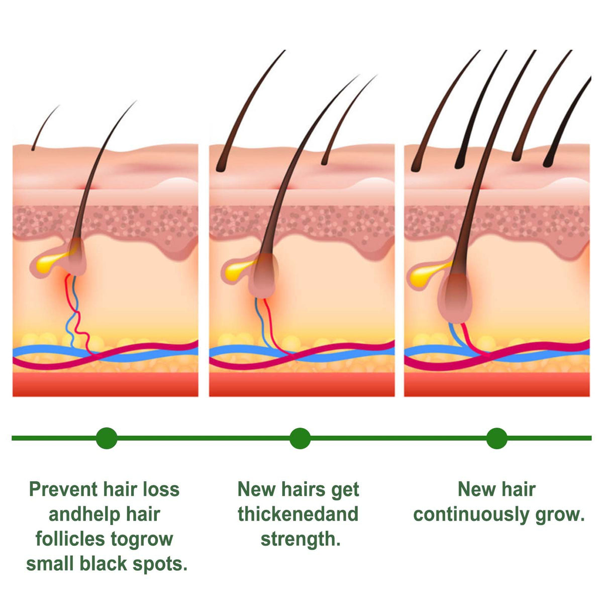 Rosemary Hair Care Capsules Nourish Roots And Prevent Loss