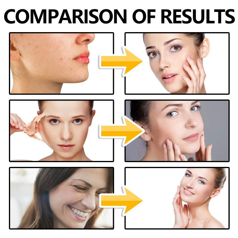 Moisturizing Facial Solution with Hyaluronic Acid - 40ml Skin Care Serum