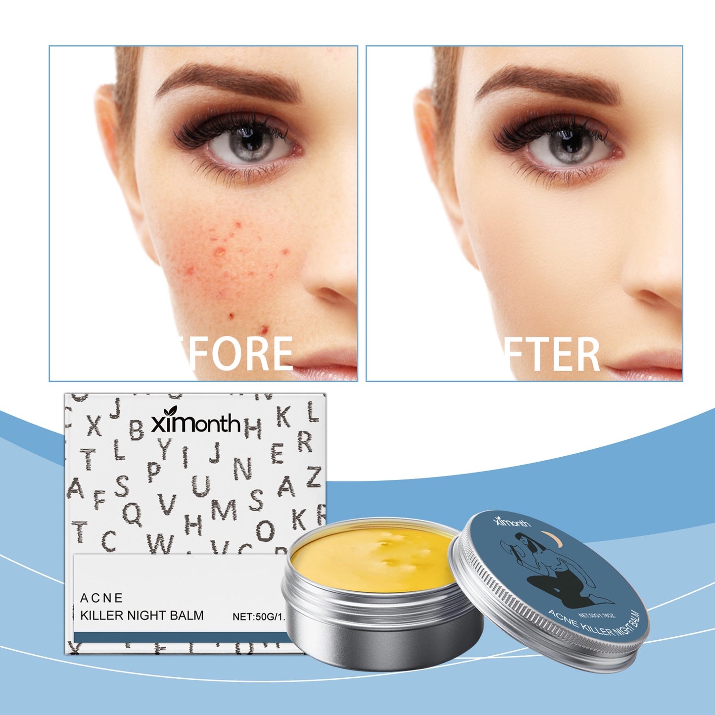Moisturizing Acne Cream 50g for All Skin Types - Gentle Skin Care