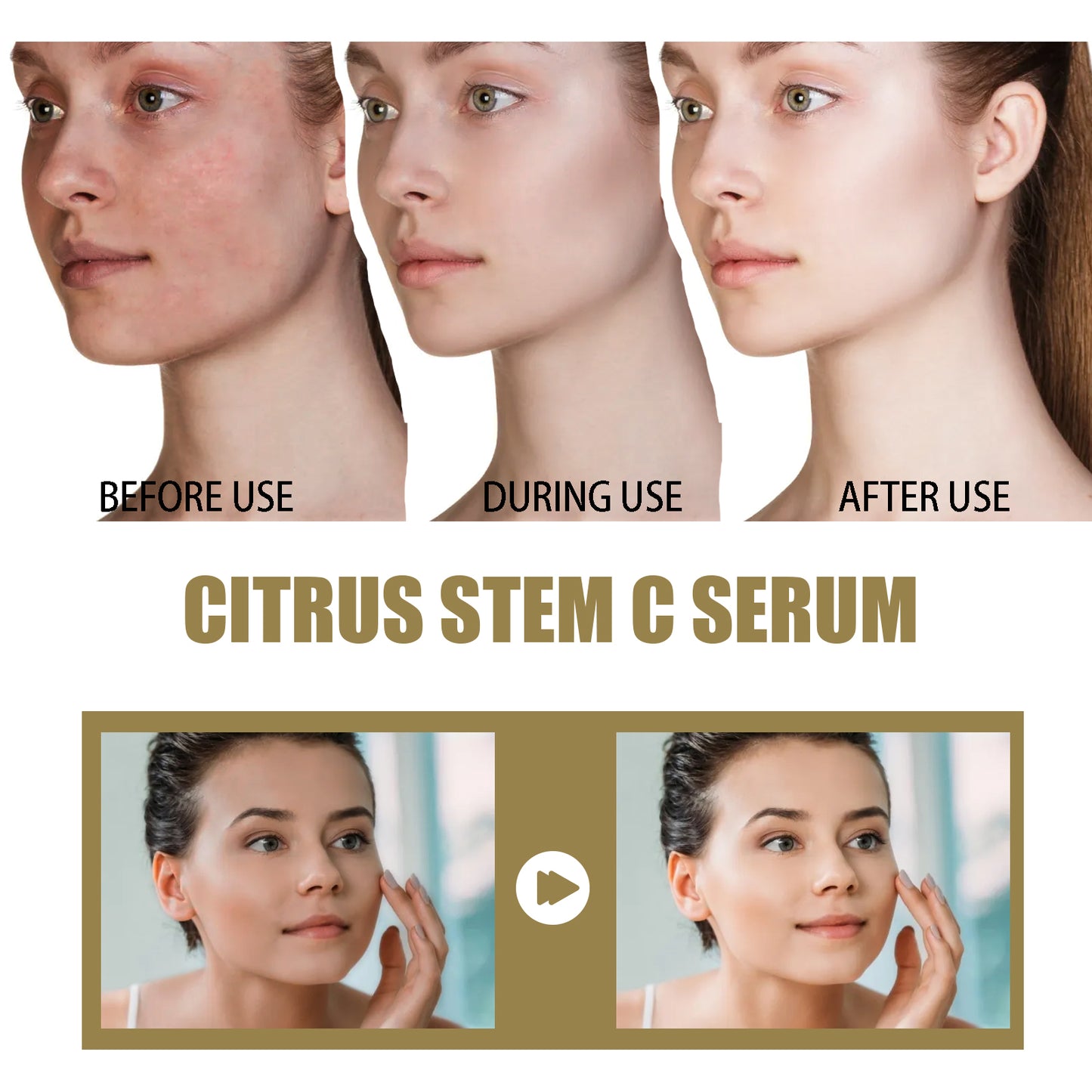 Citrus Stem C Anti-Aging Serum - 30ml Wrinkle Reducing Face Firming Essence