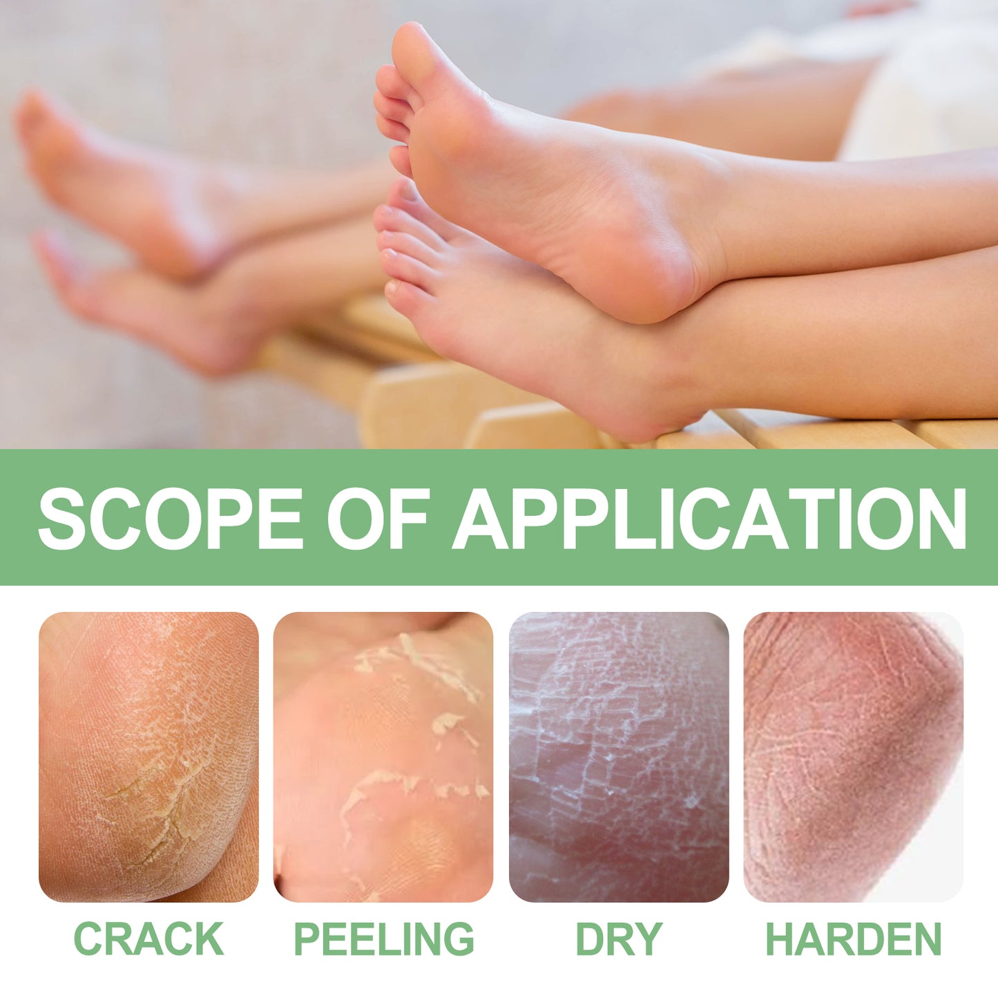 Peppermint Foot Cream for Cracked Heels - Moisturizing Foot Repair Balm