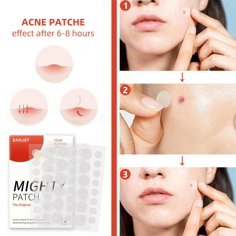 Hydrocolloid Acne Patches - 72 Count Nighttime Spot Stickers for Face