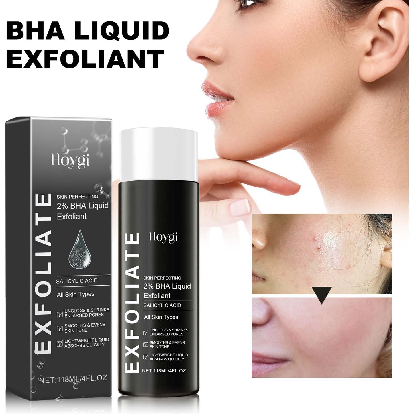 BHA Liquid Exfoliant - Pore-Tightening Facial Essence & Acne Treatment