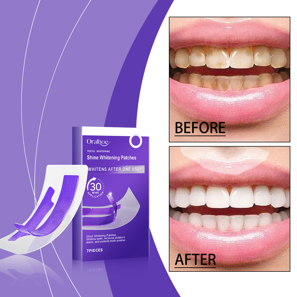Whitening Teeth Strips - 7pcs