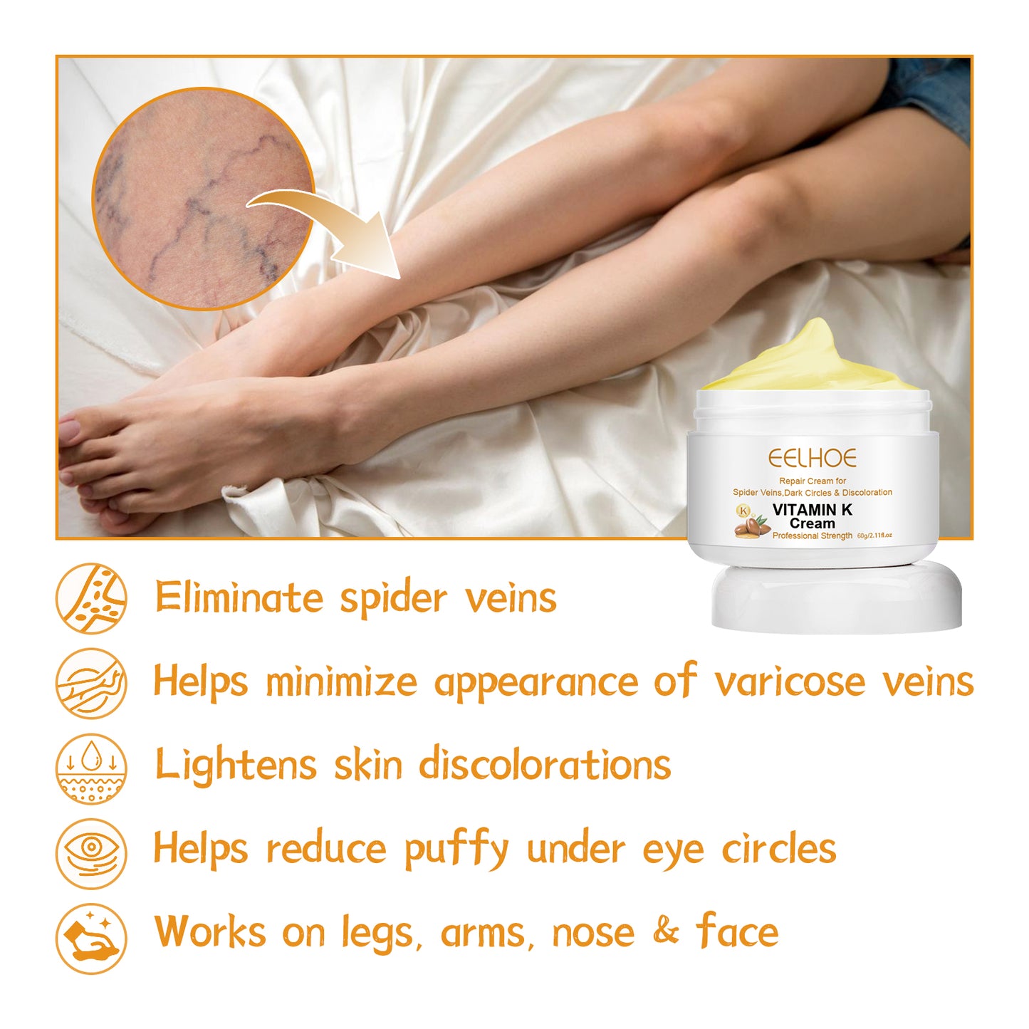 Vitamin K Cream for Varicose Veins and Bruise Relief - Soothing Leg Care