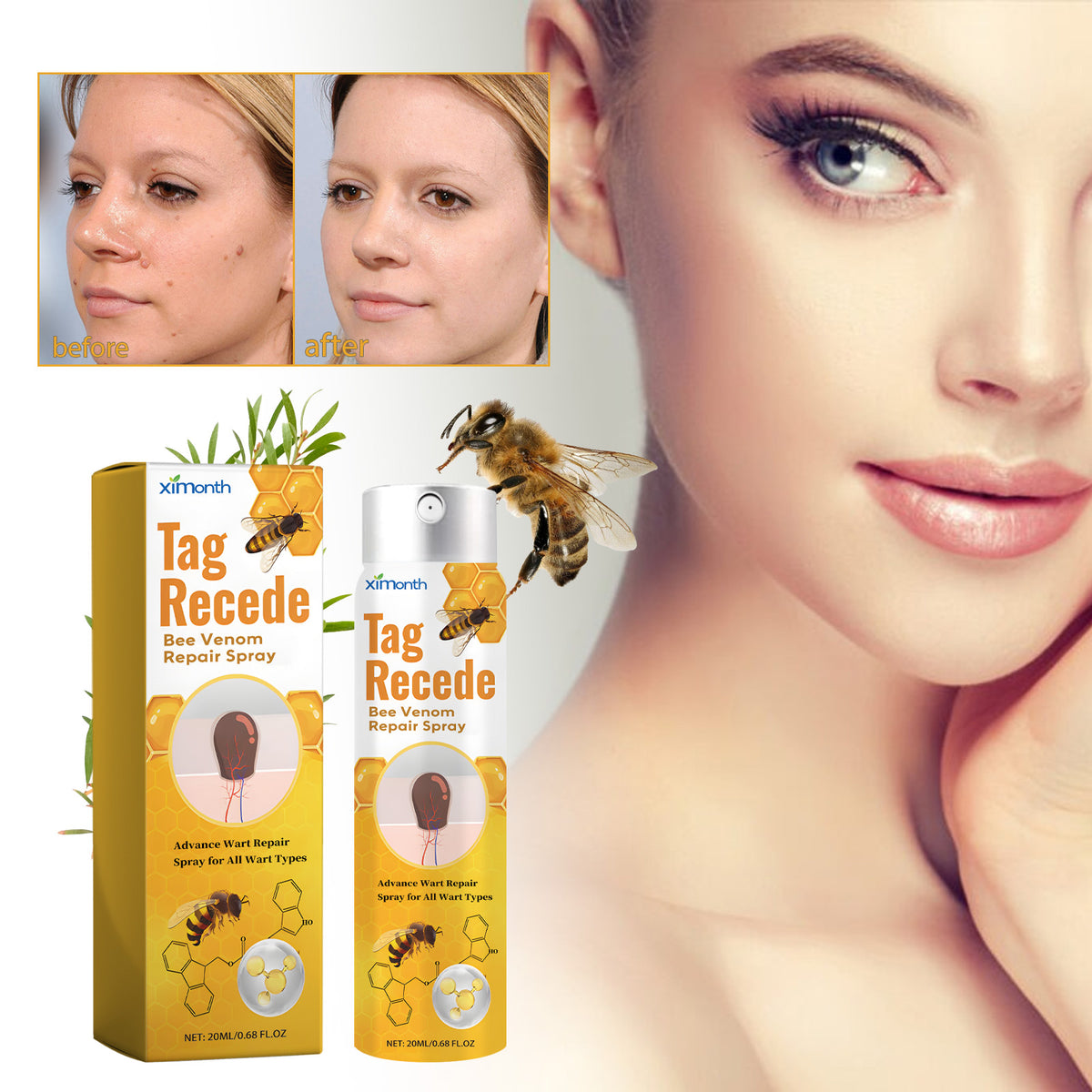 Bee Venom Cleansing Spray for Warts, Spots & Moles