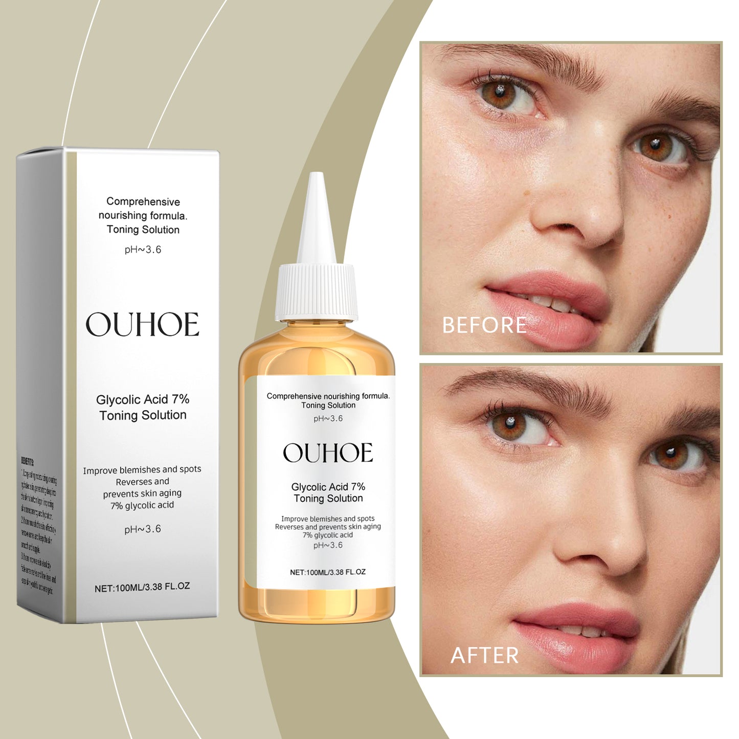 Glycolic Acid 7% Moisturizing Toner - Facial Pore Refining & Skin Brightening