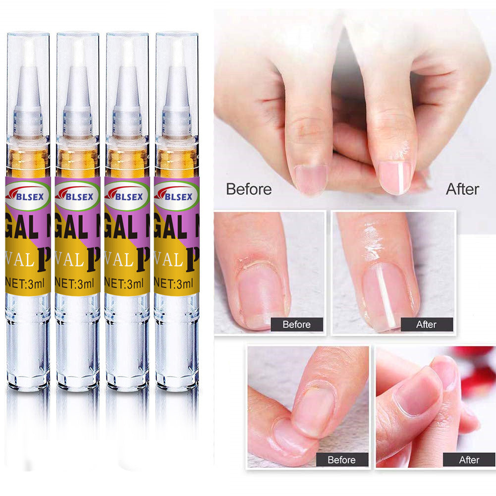 Nail Fungus Treatment Pen - 4 Pack