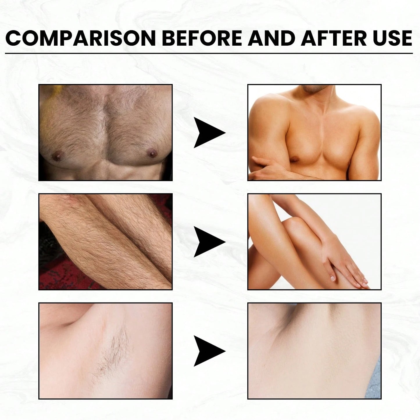 Gentle Hair Removal Cream for Face and Body - Fast Acting Moisturizing Formula