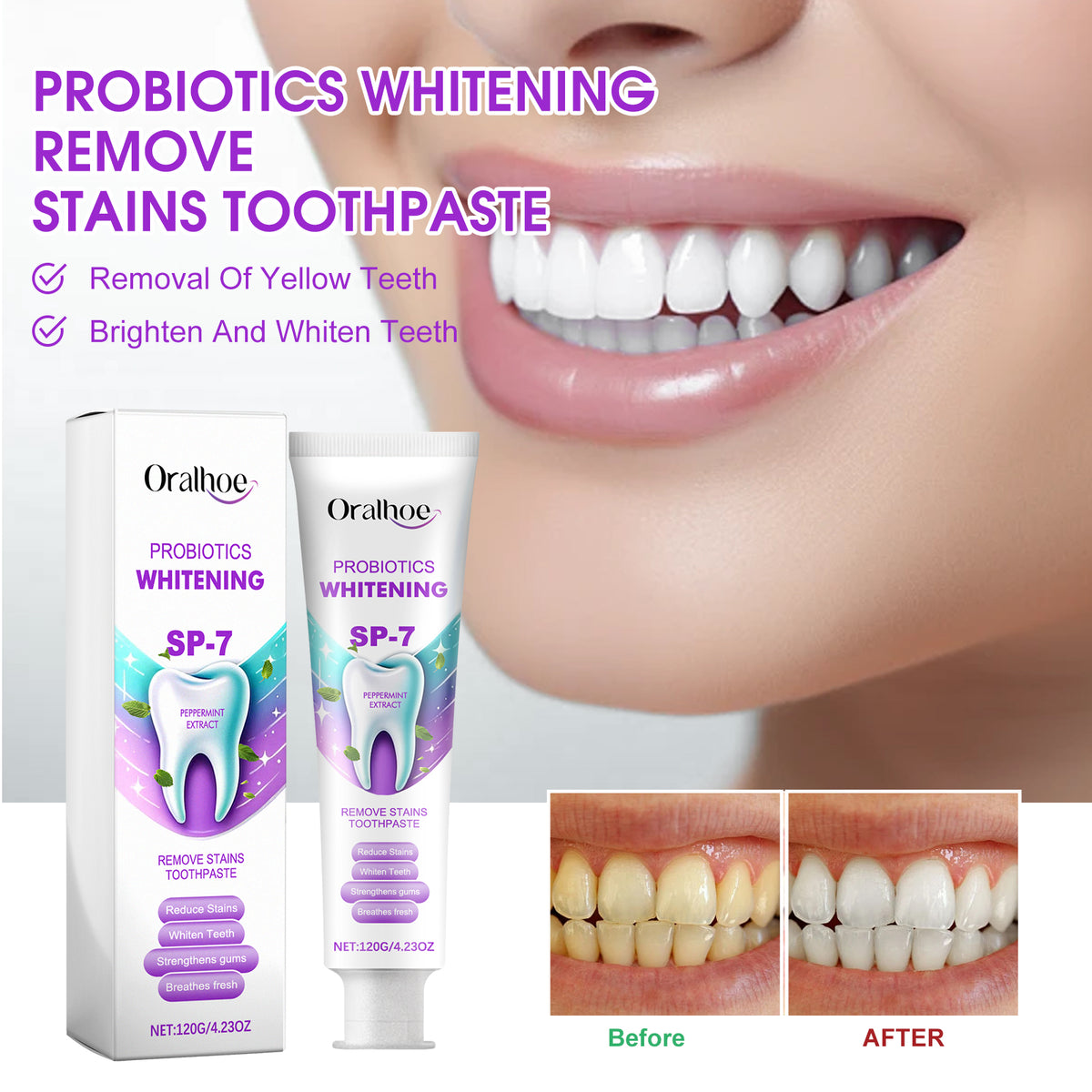 Probiotic Whitening Toothpaste 120g - Dental Care for Stain Removal & Fresh Breath