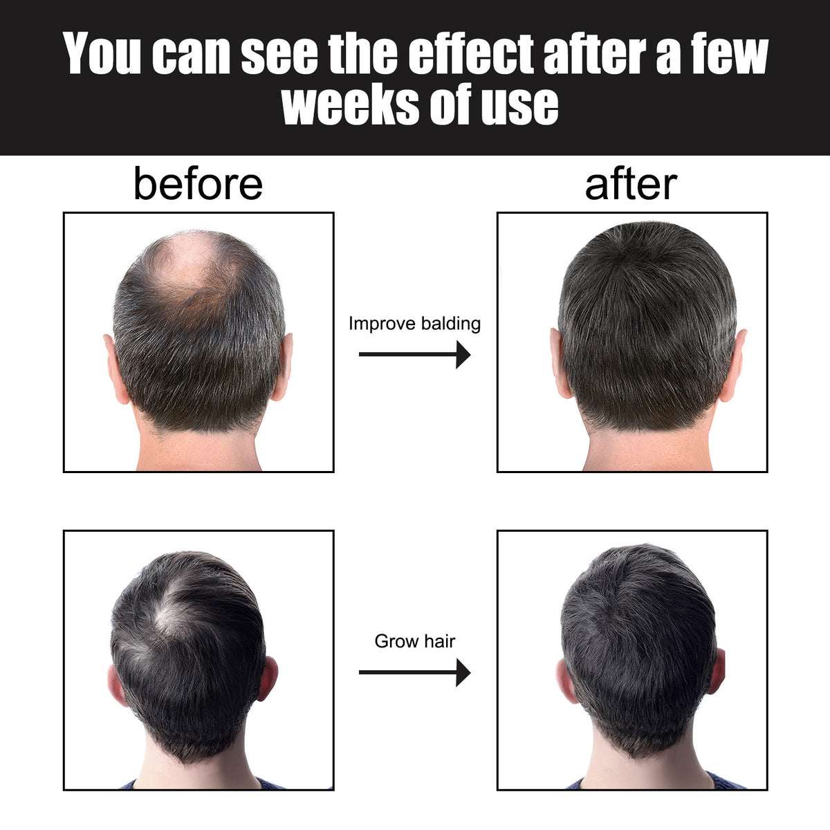 Dense Hair Essence Serum – Nutrition & Growth Support