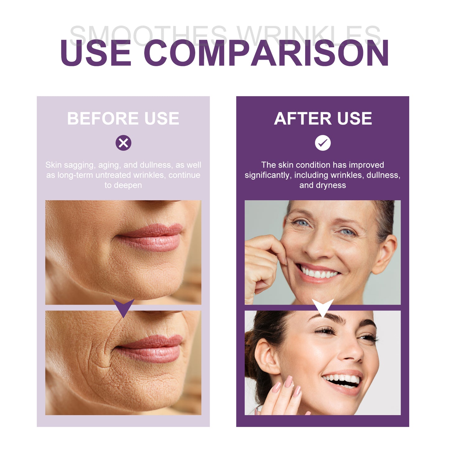 Retinol Anti-Wrinkle Face Serum with Hyaluronic Acid & Niacinamide - 30ml