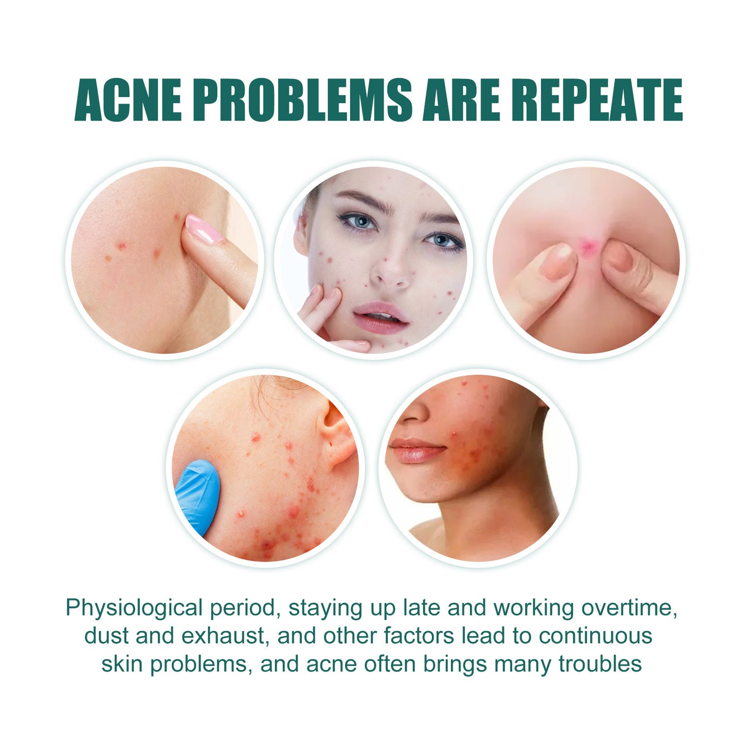 Heart-Shaped Acne Patches with Tea Tree Oil & Hyaluronic Acid