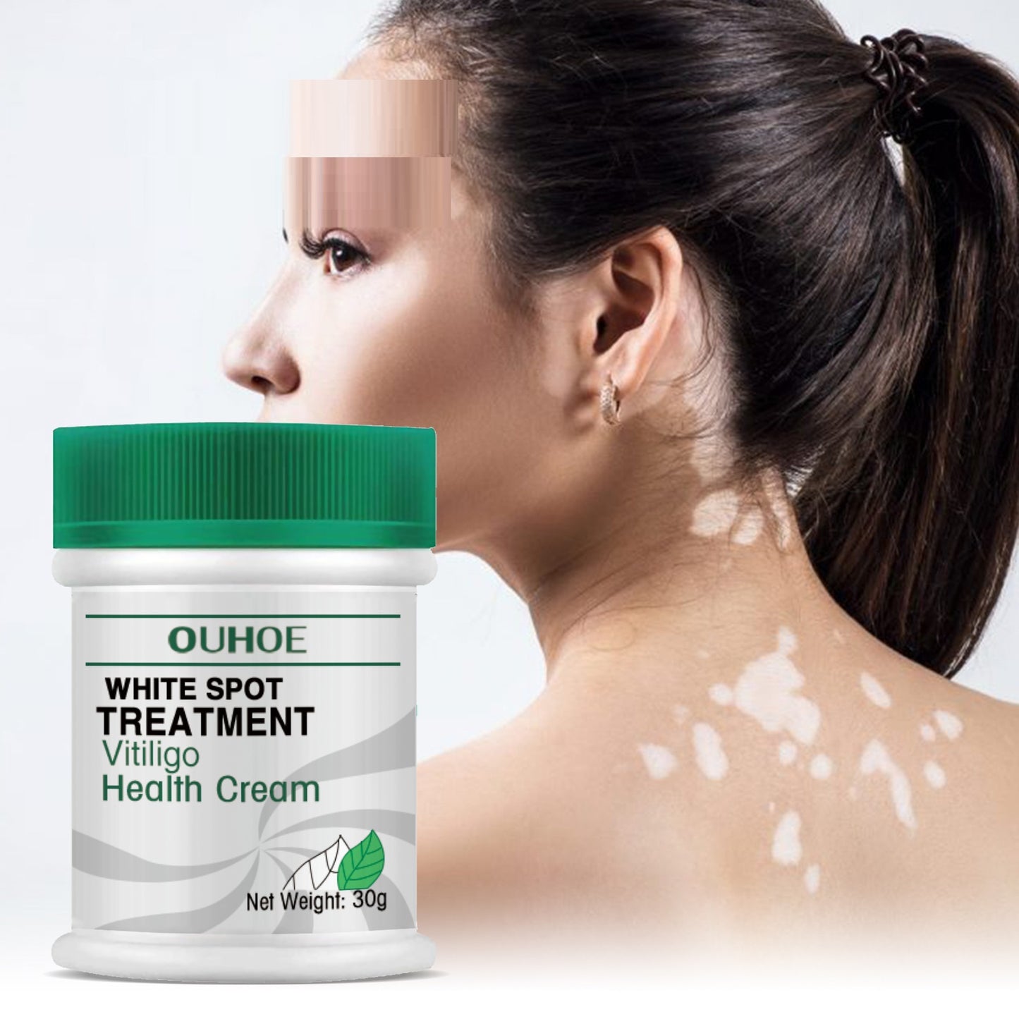 White Spot Repair Cream for Skin Fade & Melanin - 30g
