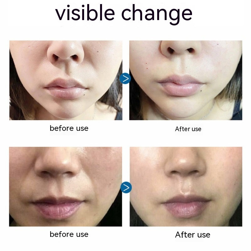 Hydrogel Anti-Wrinkle Face Patches - Firming, Hydrating, Fine Line Reduction, 5 Pieces