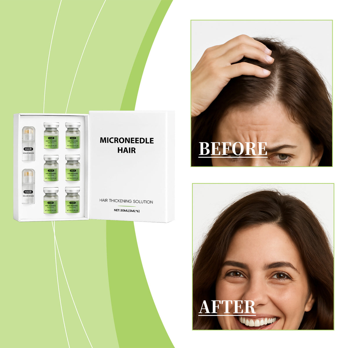 Micro-Needle Roller Serum - 5ml x 6 Pack