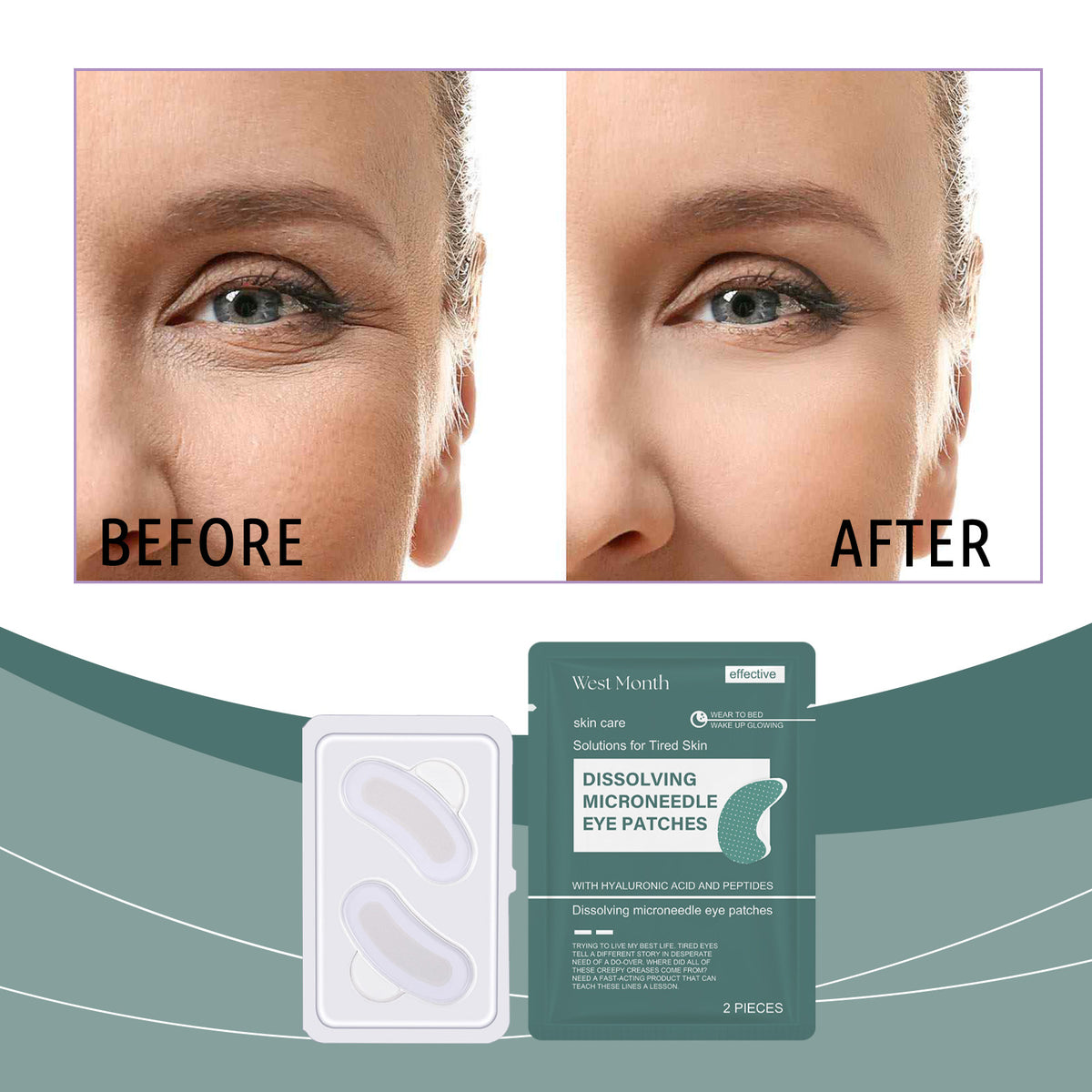 Hyaluronic Acid Microneedle Eye Mask for Eye Bags & Dark Circles - 2pcs