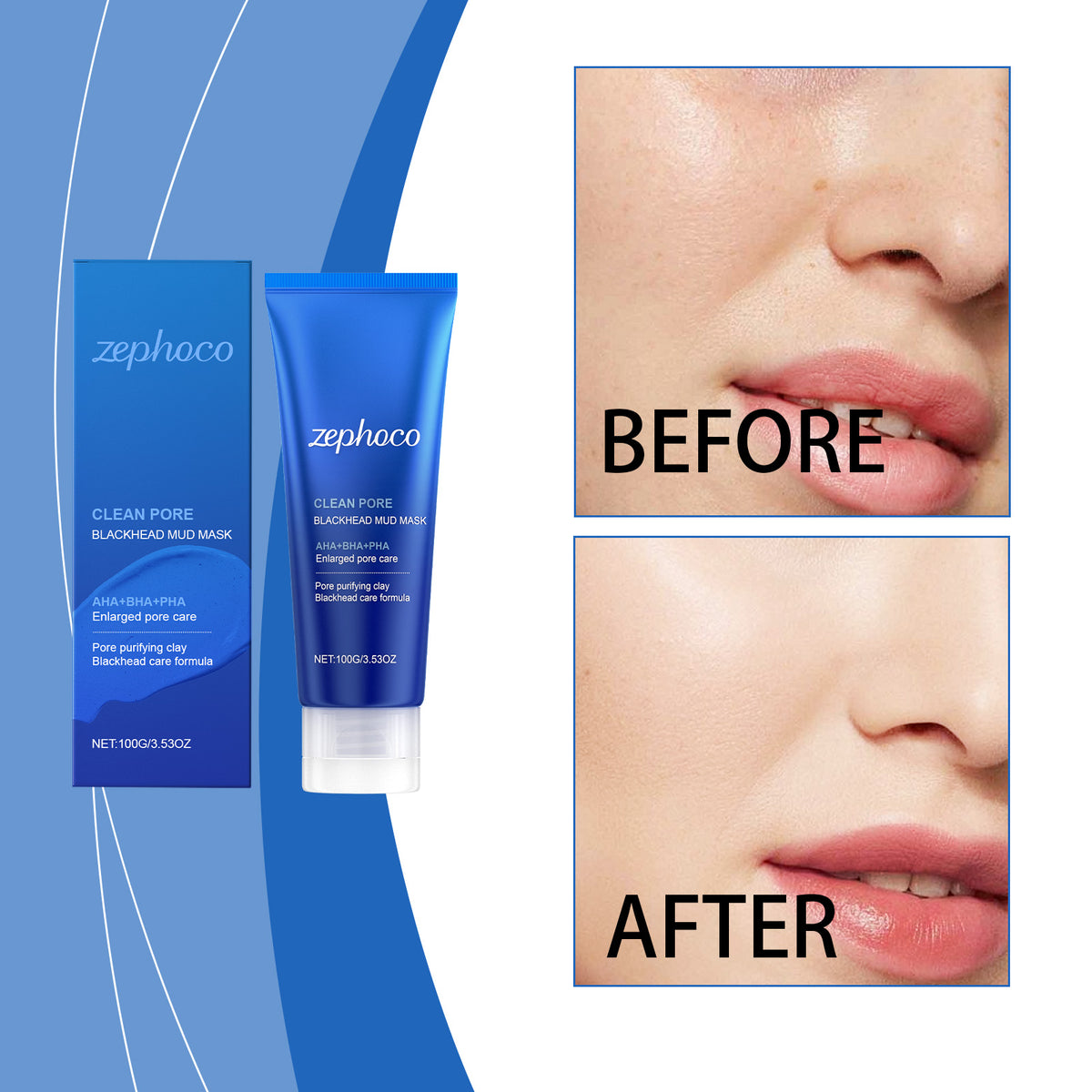 Blackhead Removal Facial Mud Mask - 100g Deep Cleansing Skin Care