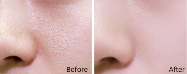 Full Coverage Concealer for Blemishes Dark Circles & Tattoos - 14g