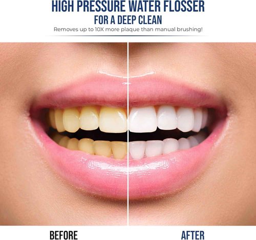 Optum Duo Flossing Toothbrush 2-in-1 Electric Toothbrush Water Flosser Combo – Sonic Toothbrush with 40k Vibrations & High Pressure Dental Flosser, 5 Brushing Modes, Ideal for Braces & Implants