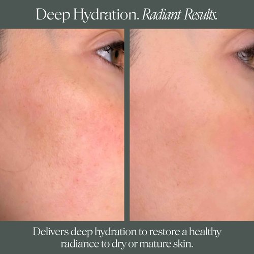 Doctor Rogers Face Cream Moisturizer: Hydrating Facial Cream. With Niacinamide, Shea Butter & Squalane. Anti-Aging & Moisturizing Lotion. Suitable for Sensitive & Dry Skin, 1.7 Ounce (50ml)