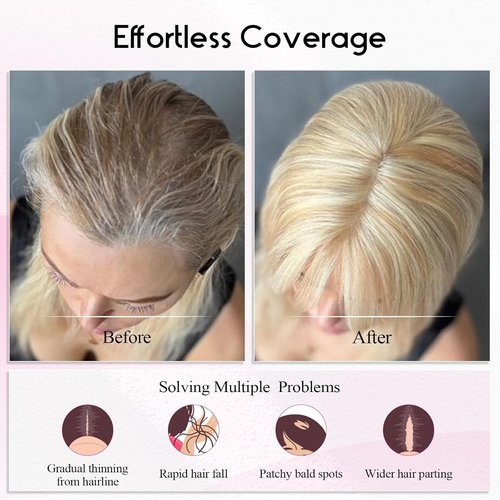 EMMOR Real Human Hair Topper for Women, Breathable Handmade Base with 3 Non-Slip Clips,100% Human Hair for Women, Top Hairpieces for Thinning Hair & Natural Looking