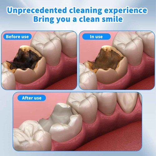 Gen Guan Ultra Cleaning Activator Sonic Irrigator with 60pcs Tips, Ergonomic Diagonal Design and Three-Speed 3D Oscillation, Clean the Internal Dirt, Blue Indicate Light