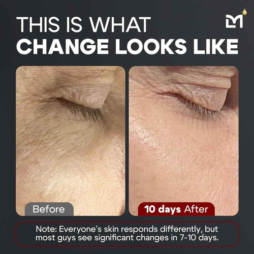 Man Labs Titan MAX Anti-Aging Peptides Serum for Face – Ultra Potency Mens Peptide Serum Moisturizer – Mens Skin Care – Men, Dark Spots, Wrinkles, Fine Lines – Peptides, 10% Niacinamide, HA –Unscented