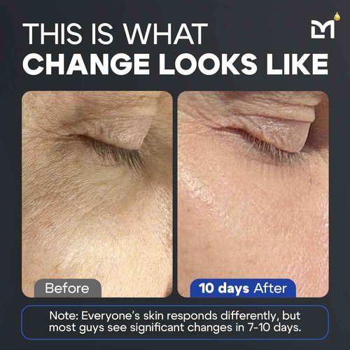 Man Labs Titan Anti-Aging Peptides Serum for Face – High Potency Mens Peptide Serum Moisturizer – Mens Skin Care – Men, Dark Spots, Wrinkles, Fine Lines – Peptides, 5% Niacinamide, HA – Unscented