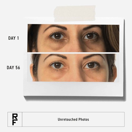 RODAN + FIELDS Active Hydration Bright Eye Complex | 15ml | Moisturizing Under Eye Cream for Dry Skin | Eye Treatment for Refreshed Appearance | Skincare