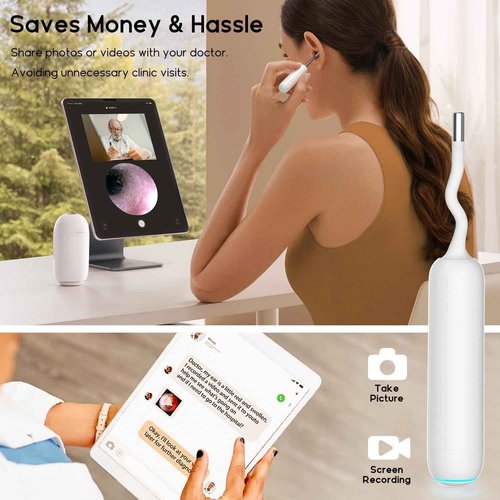 Bebird Home 30S Ear Wax Removal, Smart Ear Care System Cleaner Kit, Wireless Scope Silicone Flex Earscope Camera, UVC LED Light, Visual Wax Cleaning Dropper, Wax Removal Tweezer Tool Adult/Kids