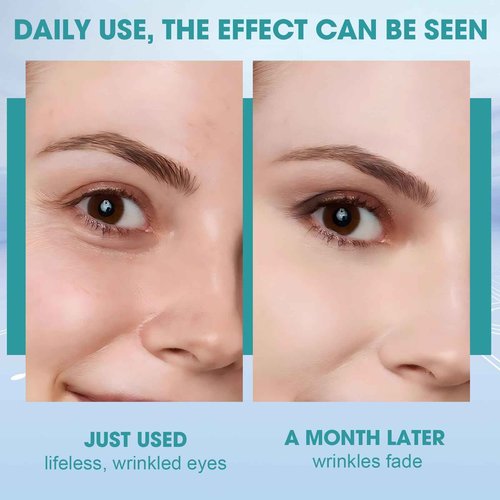 Red Light Therapy for Eyes, 5 Modes LED Eye Mask for Skin Rejuvenation, Anti-Aging, Boost Collagen, Under Eye Red Light Therapy Device for Dark Circles, EyeBags, Wrinkles