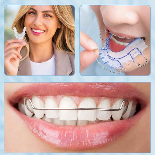 Custom Fit Hawley Retainer After Braces, Durable Dental Retainer, Upper & Lower Hawley Retainers for Teeth for Adults & Kids, 2 Pack