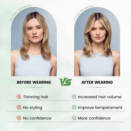 HOLFWALF Hair Toppers for Women Upgrade Swiss Lace Base Hair Topper 10inch Hairpieces for Women with Hairloss (Ombre Medium Brown with Blond Highlight)