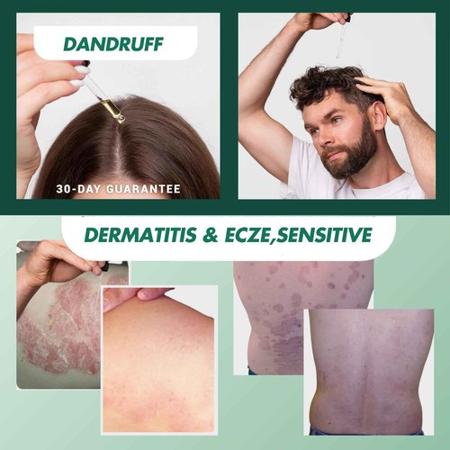 ABERA Alan Silver Serum – Botanical Hydrating Serum for Dry & Sensitive Skin & Herbal Extracts – Daily Moisturizer for Face, Body & Scalp – Fast Absorbing, Lightweight – (2 boxes)