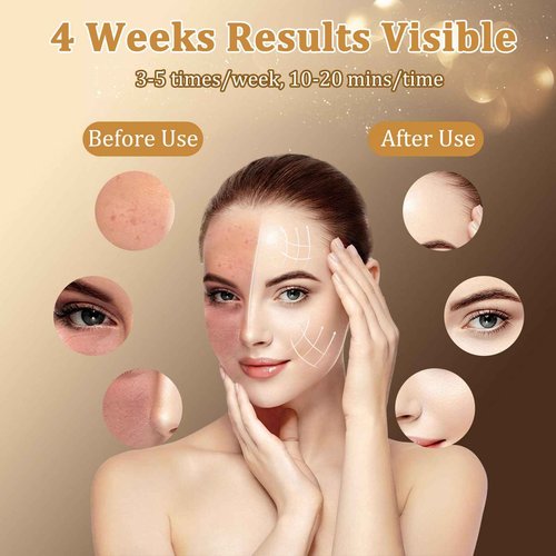 Red Light Therapy for Face, 8 Colors LED Face Mask Light Therapy with 850NM Near-Infrared, 3000 mAh Rechargeable Red Light Therapy Mask, Skin Care Device at Home and Travel for Skin Rejuvenation