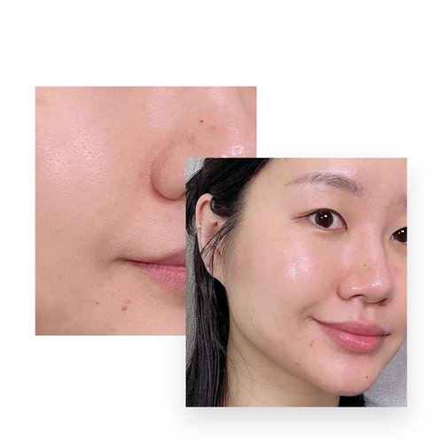 CELONIA Signature Bio Energy Essence Face Mist, Korean Anti-Aging Stem Cell Skin Care, Calming Hydrating Facial Essence Spray For All Types Of Skin, Reduce Redness, Stay Fresh And Glowing 100ml