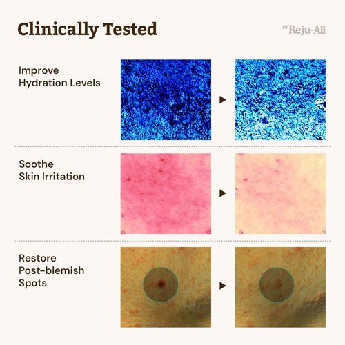 Dr. Reju-All Advanced PDRN Rejuvenating Cream – 99% Pure Salmon DNA PDRN Face Moisturizer – Optimal 1200ppm Concentration for Glow Skin – Korean Anti-Aging Skin Care Face Cream - 2.0 Fl Oz