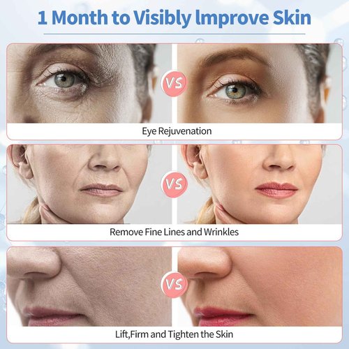 Texet Microcurrent Facial Device, Facial Massager, Home Use Skin Tightening Machine Light Therapy for Face Eye Neck Lifting 6 in 1 Skin Care Tool