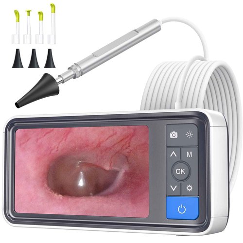 ScopeAround Otoscope Ear Camera with 4.5" IPS Screen, FHD Digital Otoscope with Gyroscope, FSA HSA Eligible Item, 32GB Card Ear Scope Otoscope with Light, Ear Wax Removal Tool Camera, Home Ear Checker