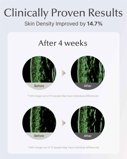 SOORYEHAN Lifting Ampoule Serum (2.02fl oz) - Triple-Action Anti-Aging Serum for Skin Tone, Texture, and Elasticity with 5% Niacinamide and Triple Collagen Blend
