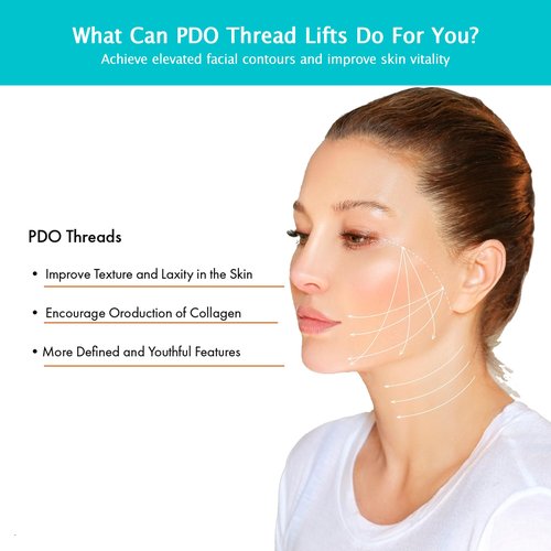 RYZESKI PDO Screw Thread, Lift Face Tip Screw Threads, PDO Threads Face Lifting Face & Whole Body (100PCS-29G*38mm)