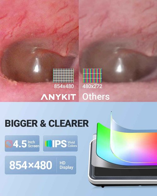 Anykit Digital Otoscope with Gyroscope, 4.5 Inches Screen, 3.9mm Ear Scope Camera with 6 Lights, Ear Wax Removal Tool, 32GB Card, Supports Photo Snap and Video Recording