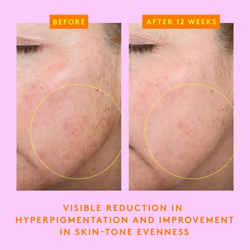 Drunk Elephant C-Firma Fresh Day Serum - 28 ml/.94 fl oz - 15% Illuminating Vitamin C - Clean Clinical Skincare - Cruelty-Free - Dermatologist-Tested - Free of Essential Oils, Silicones, and Fragrance