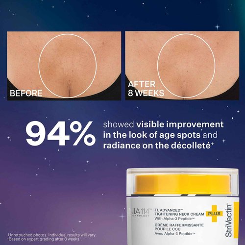 StriVectin TL Advanced™ Holiday Duo Tighten and Sculpt Kit, Brighten and Lift Skin Tone, Peptides and Hyaluronic Acid
