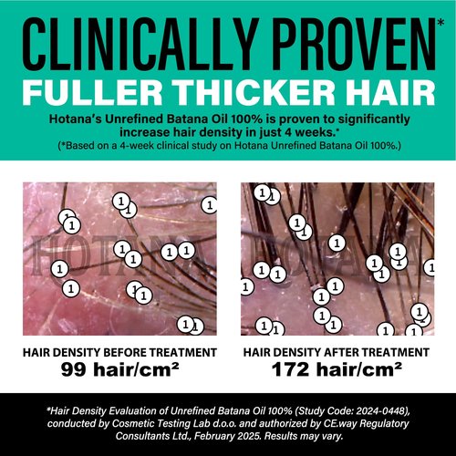 Batana Oil for Hair Growth + Batana Shampoo & Conditioner | Authentic and Natural Formula for Hair Growth & Strengthening